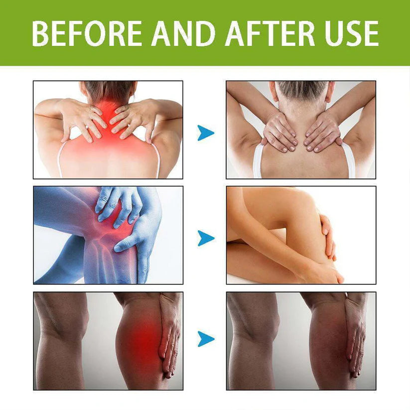 Bee Venom Pain Relief Cream | Buy 1 Get 2 Free đĽ