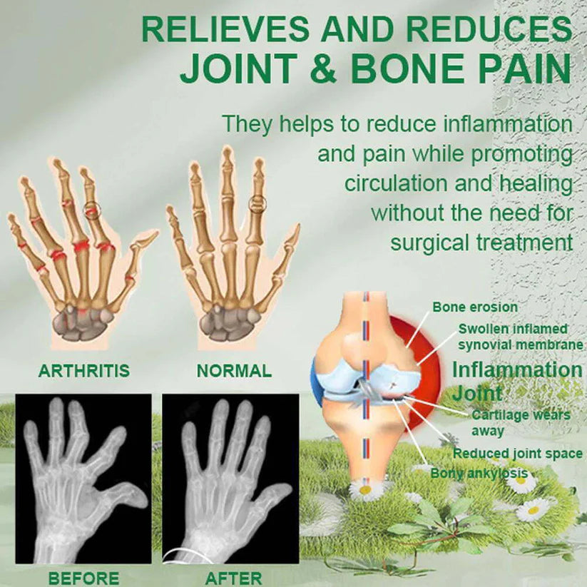 Bee Venom Pain Relief Cream | Buy 1 Get 2 Free đĽ