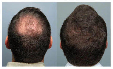 2 Ltr | Amla, Aritha & Shikakai Shampoo with Conditioner