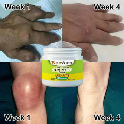 Bee Venom Pain Relief Cream | Buy 1 Get 2 Free 🔥