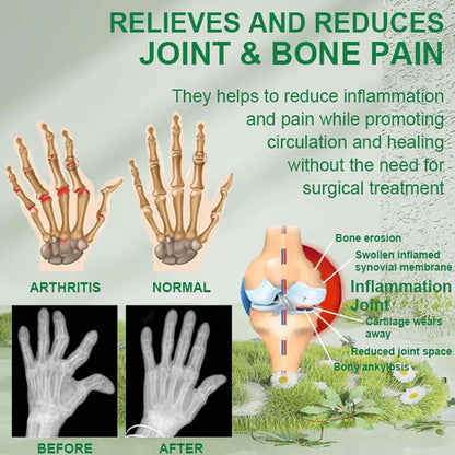 Bee Venom Pain Relief Cream | Buy 1 Get 2 Free 🔥